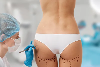 Plastic Surgery in Budapest